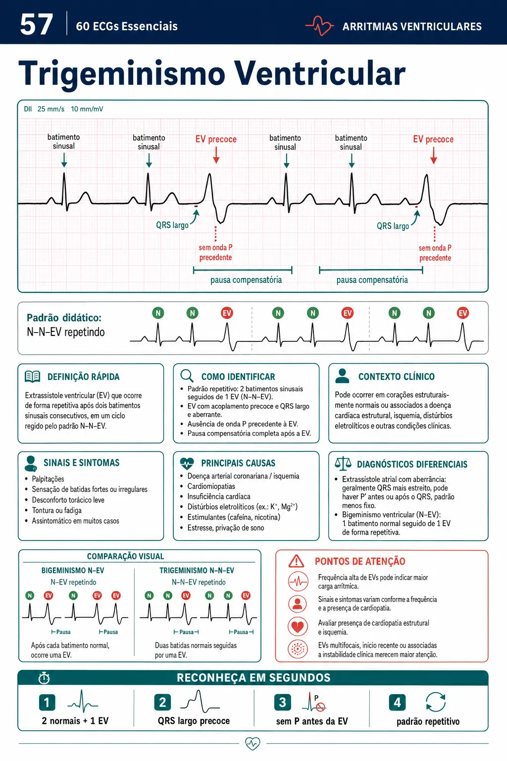 Página demonstrativa do material 60 ECGs Essenciais sobre Trigeminismo Ventricular