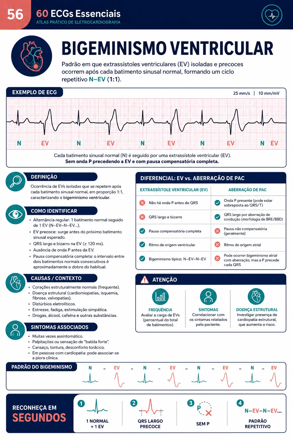 Página demonstrativa do material 60 ECGs Essenciais sobre Bigeminismo Ventricular
